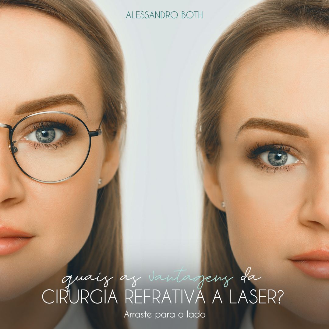 cirurgia refrativa a laser em ponta grossa