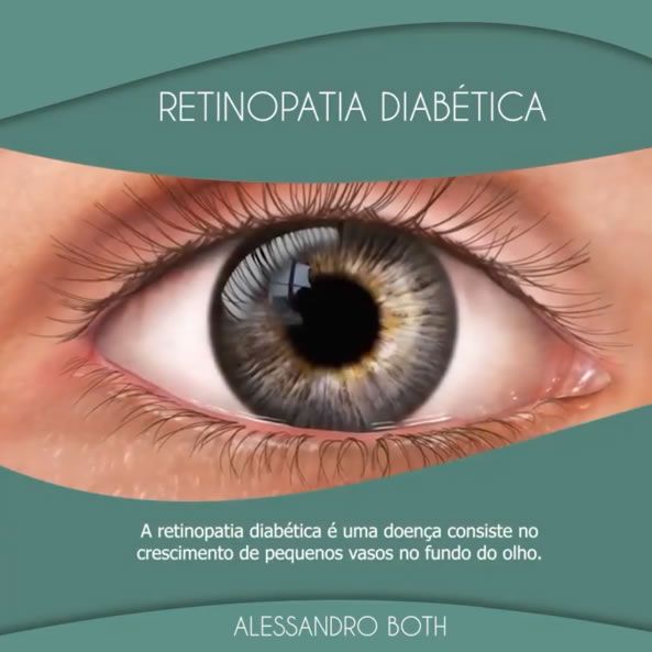 tratamento da retinopadia diabetica em ponta grossa