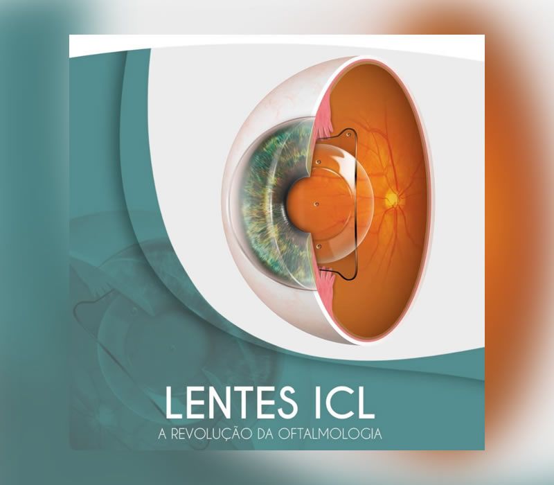 Lentes ICL em Ponta Grossa
