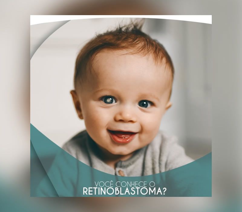 Tratamento de Retinoblastoma em Ponta Grossa