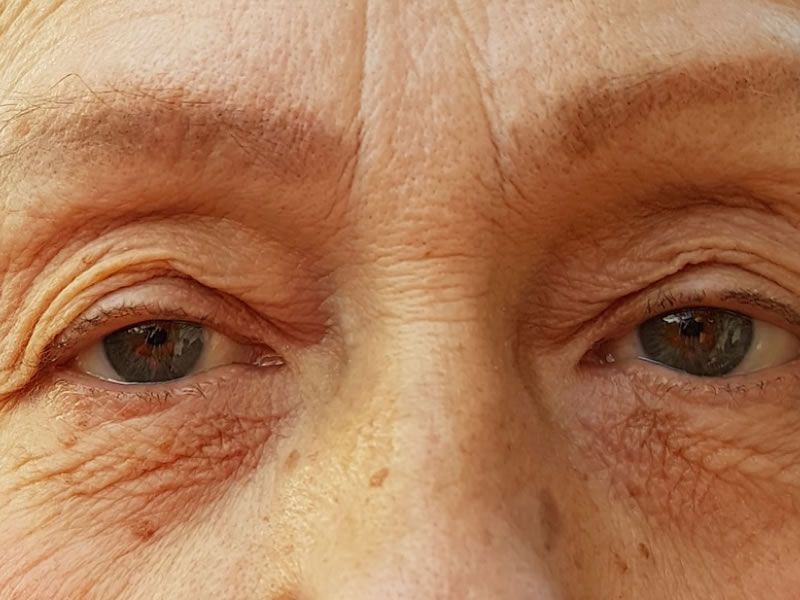 cirurgia de catarata em ponta grossa operacoes de cataratas no olho