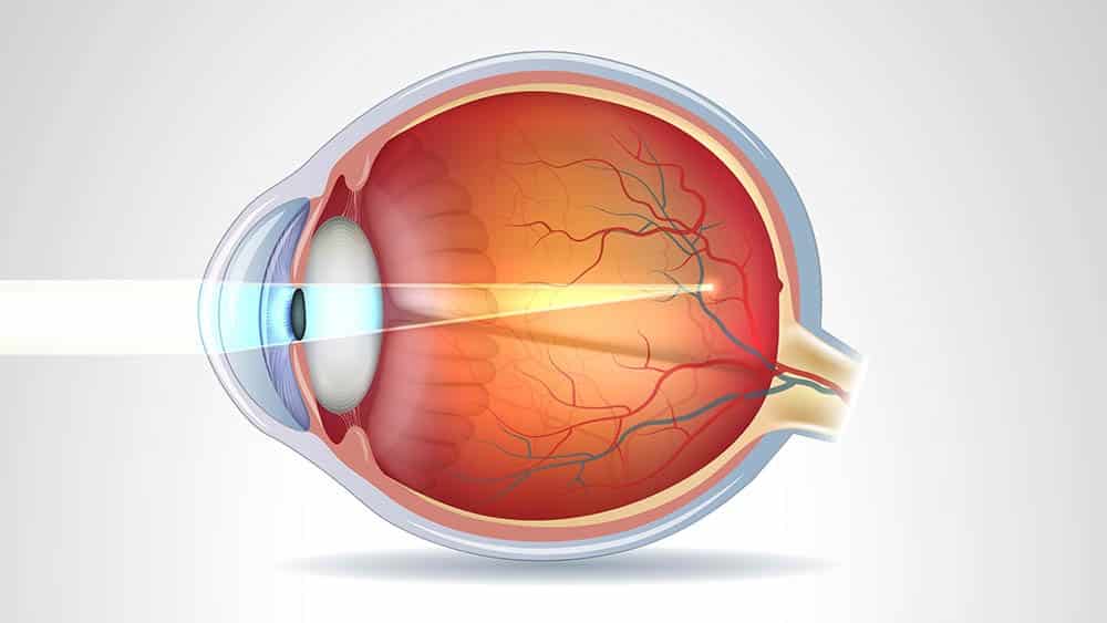 cirurgia refrativa em ponta grossa