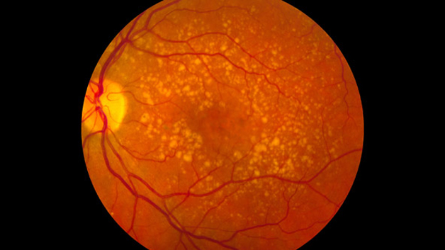 tratamento dmri ponta gorssa