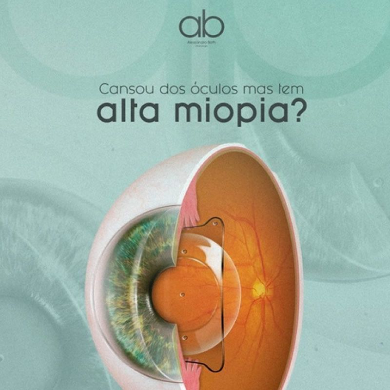 lentes ICL para tratamento de miopia em ponta grossa