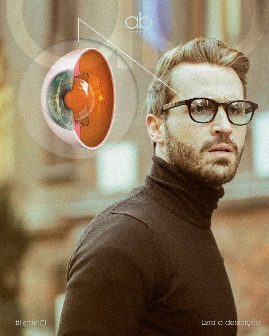 Lentes ICL para Erros Refrativos em Ponta Grossa