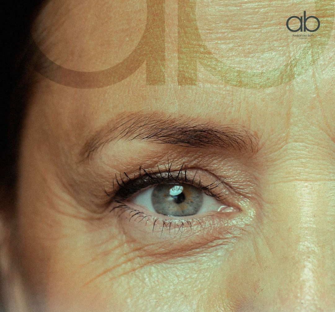 Lentes Trifocais para Cirurgia de Catarata em Ponta Grossa