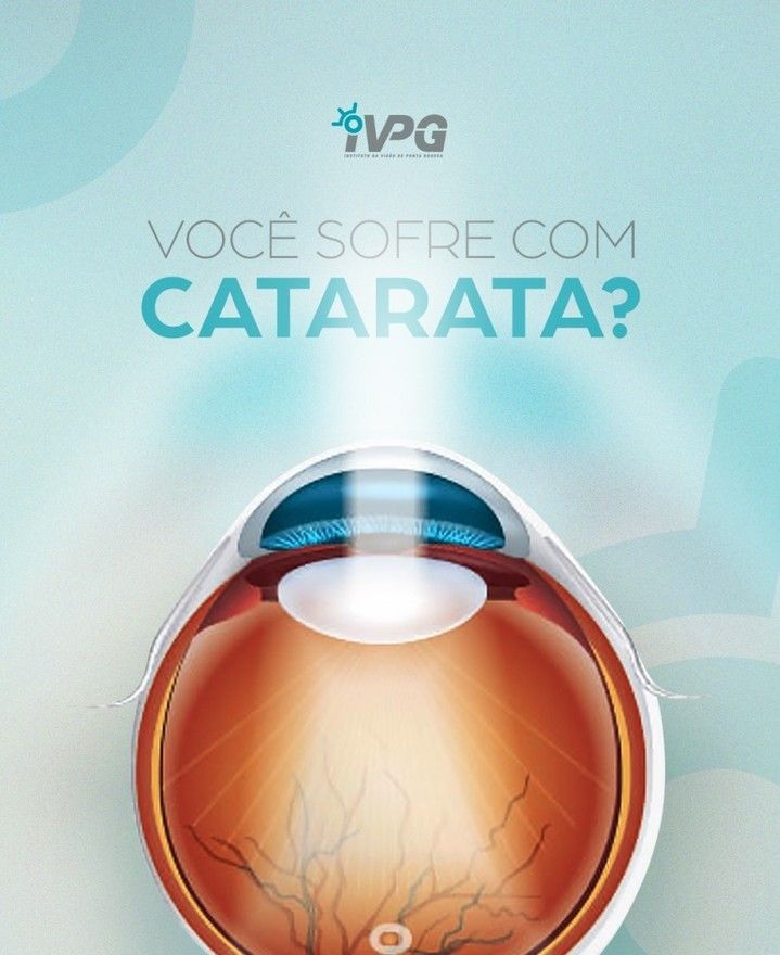 Cirurgia de Catarata em Ponta Grossa