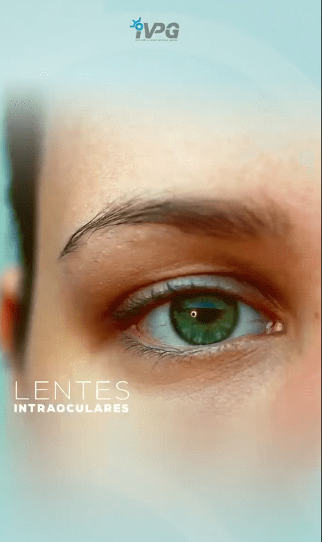 Confira o Procedimento para as Lentes ICL e1675973085496