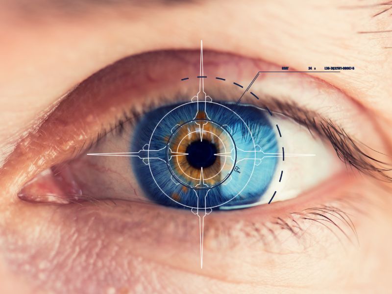 Cirurgia Refrativa a Laser em Ponta Grossa