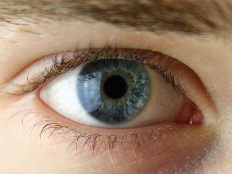 Cuidados Cruciais Entendendo e Lidando com a Retinopatia Diabetica em Ponta Grossa