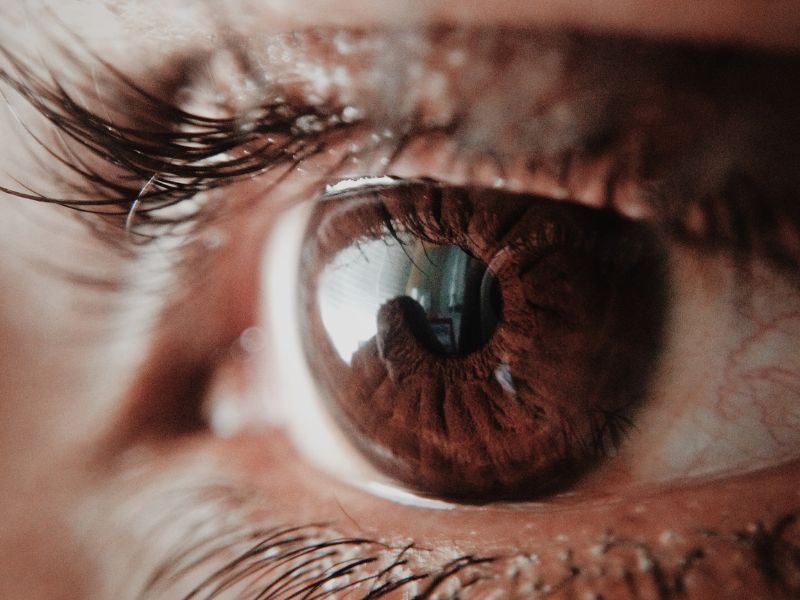 Tipos de Cirurgia Refrativa Disponiveis em Ponta Grossa