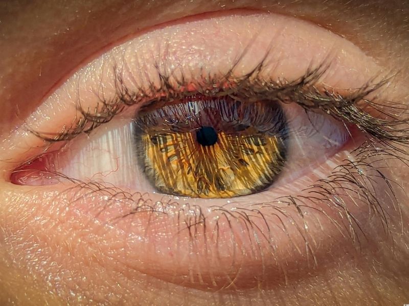 Tratamento da Miopia em Ponta Grossa